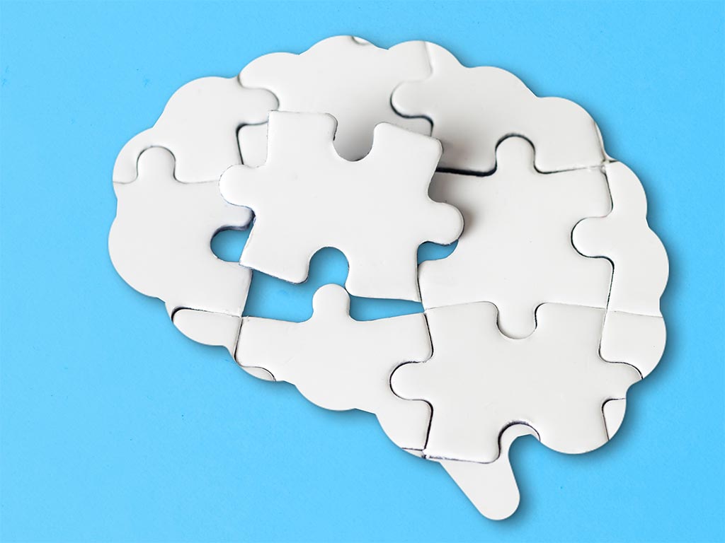 Library Lovers: Worried about your memory